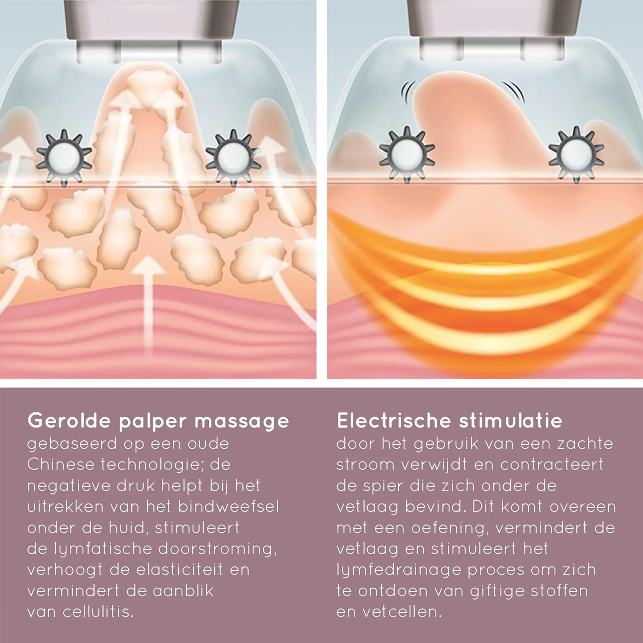 Homedics Cell-500 slimming machine image