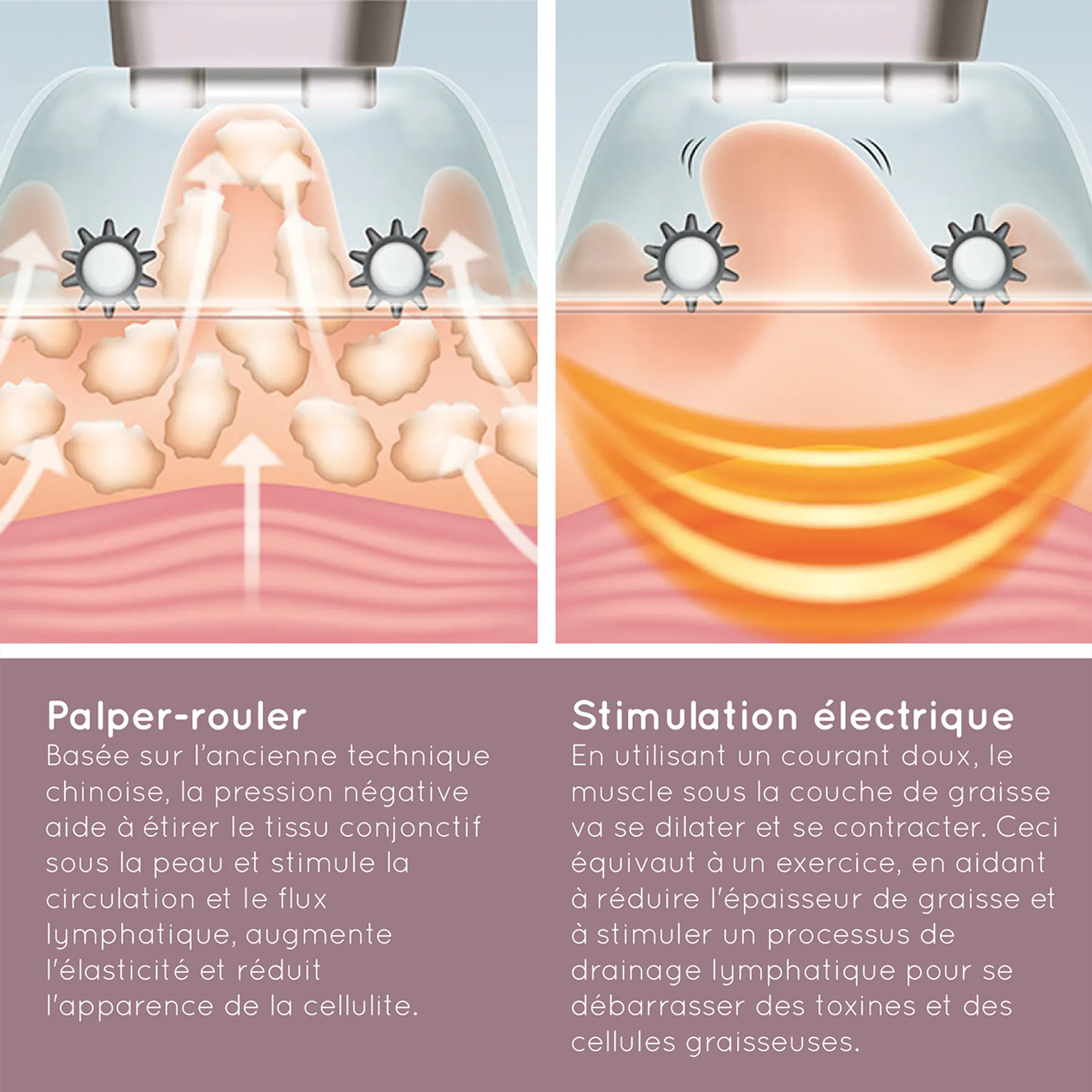 Homedics Cell-500 slimming machine image