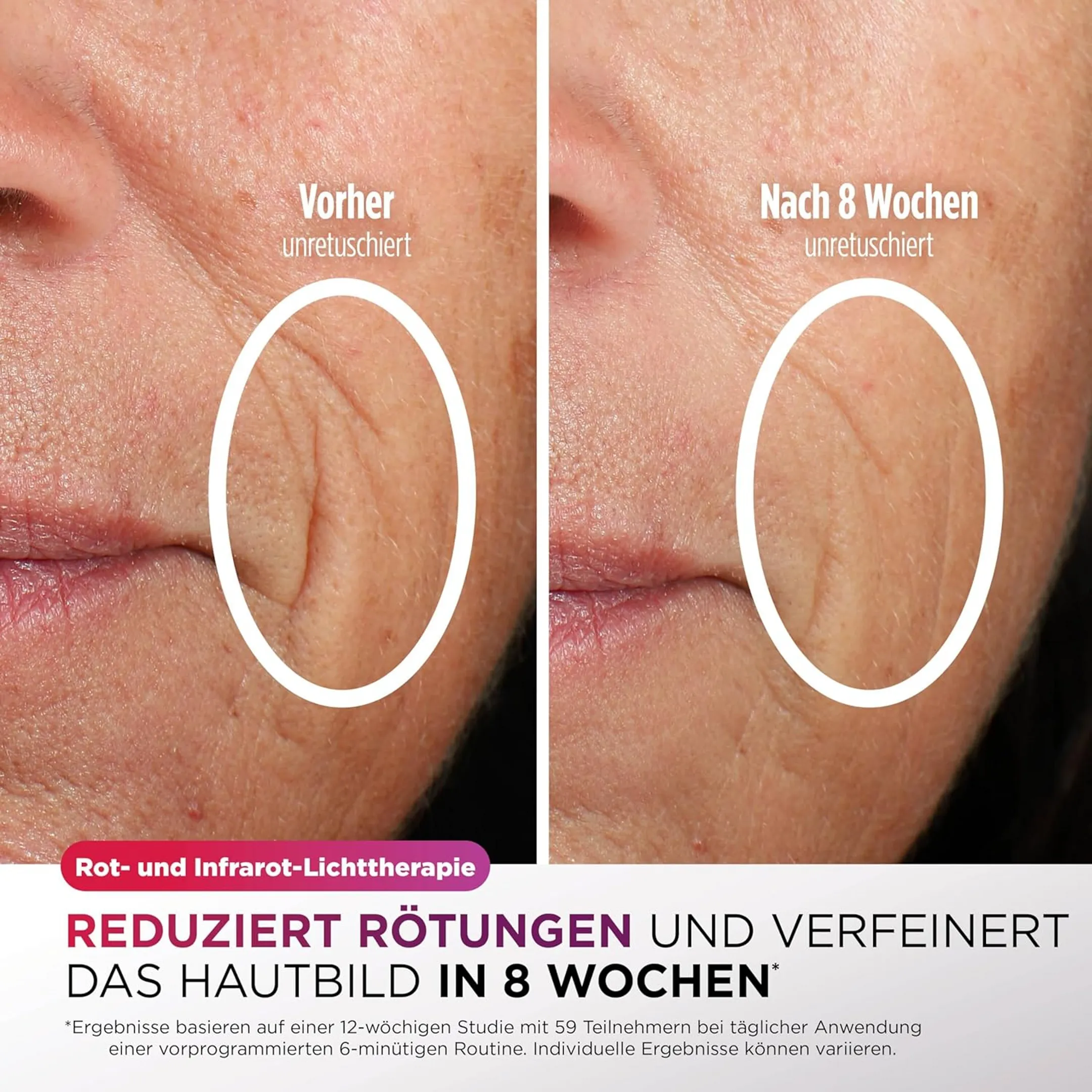 Shark LED-Maske CryoGlow FW312EUPL image