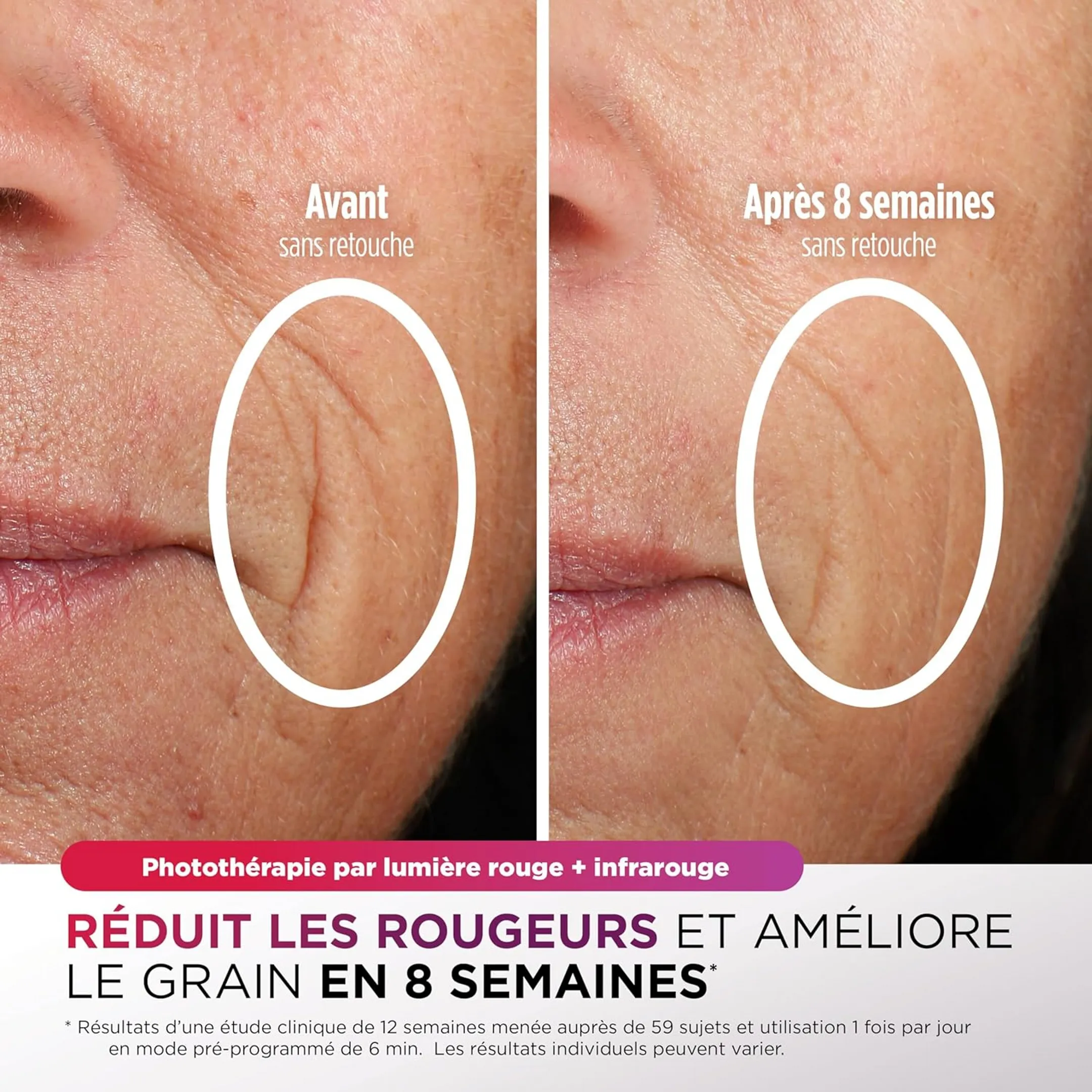 Shark Masque LED CryoGlow FW312EUPL image